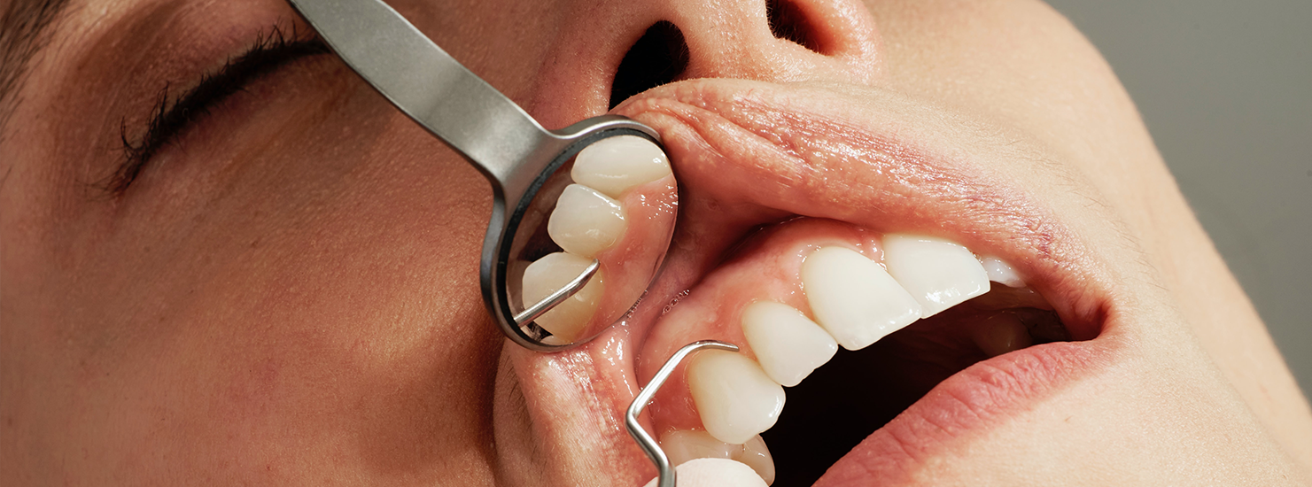 Dental